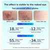 GlowSpot™ LED Acne Therapy Patch