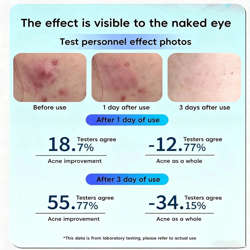 GlowSpot™ LED Acne Therapy Patch