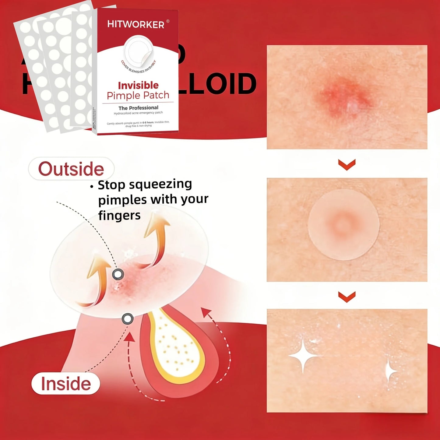 ClearSpot™ Hydrocolloid Patches